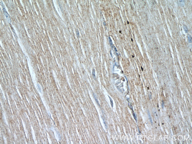 OBSCN Antibody in Immunohistochemistry (Paraffin) (IHC (P))