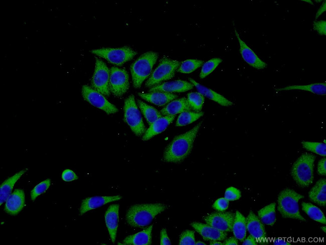 MMP21 Antibody in Immunocytochemistry (ICC/IF)