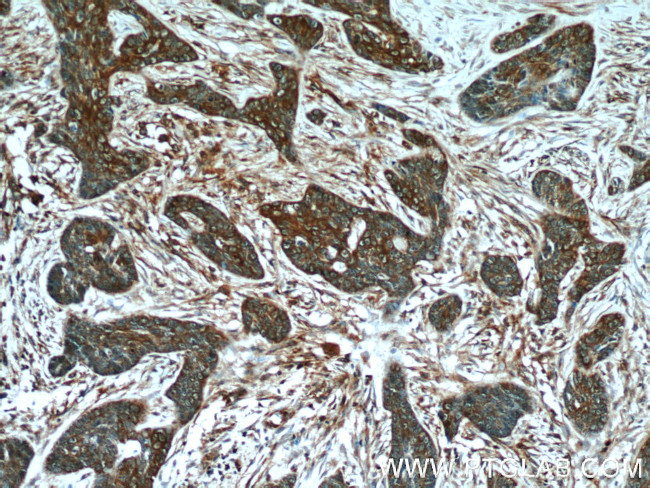 MMP21 Antibody in Immunohistochemistry (Paraffin) (IHC (P))