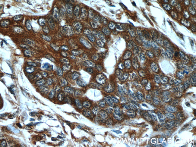 MMP21 Antibody in Immunohistochemistry (Paraffin) (IHC (P))