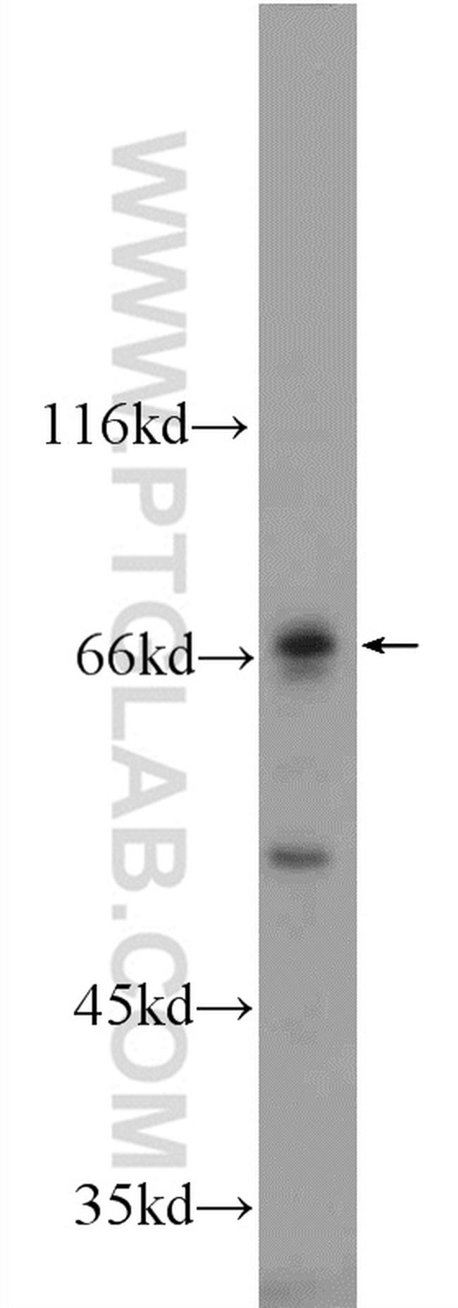 MMP21 Antibody in Western Blot (WB)