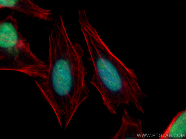 FBXW7 Antibody in Immunocytochemistry (ICC/IF)