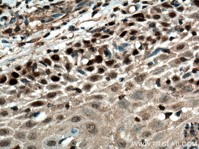 FBXW7 Antibody in Immunohistochemistry (Paraffin) (IHC (P))