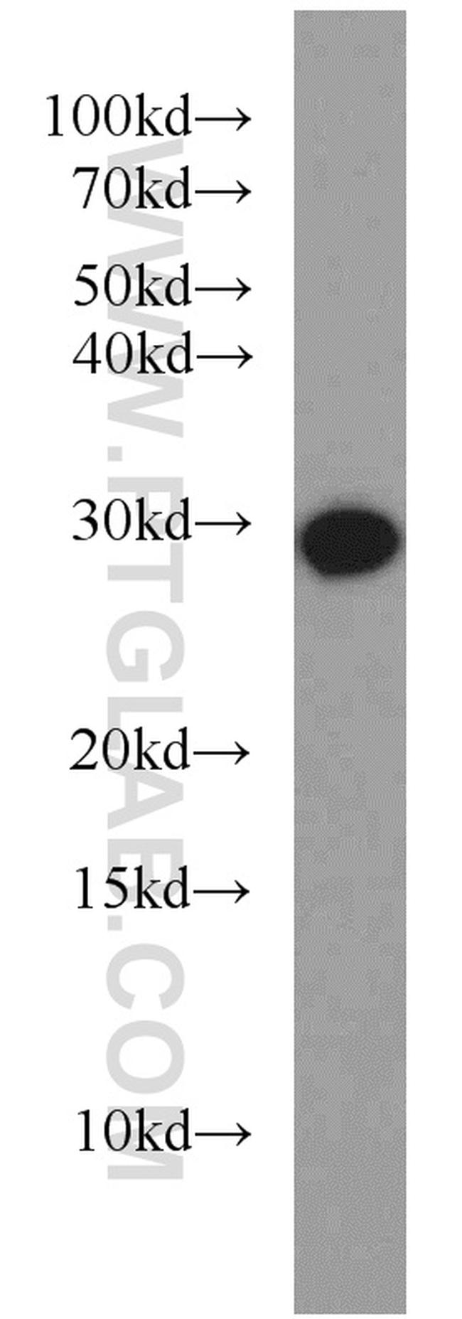 RAB8B Antibody in Western Blot (WB)