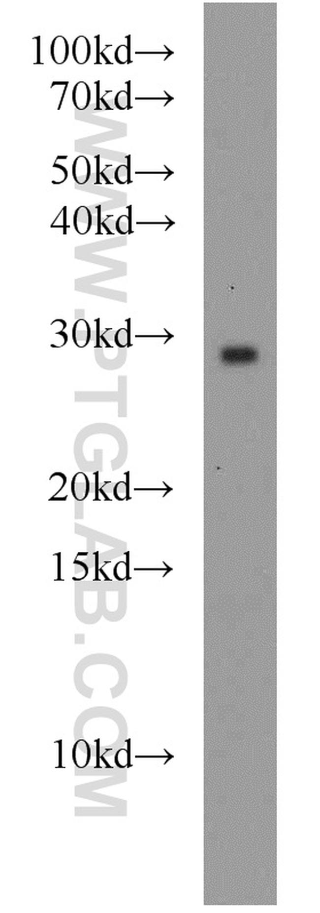 RAB8B Antibody in Western Blot (WB)