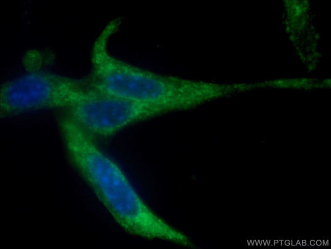 RAB8A Antibody in Immunocytochemistry (ICC/IF)