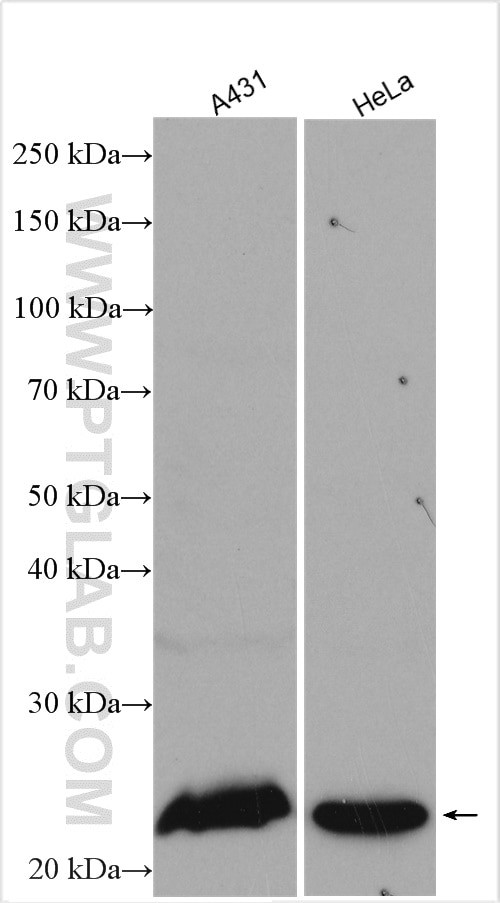 RAB8A Antibody in Western Blot (WB)