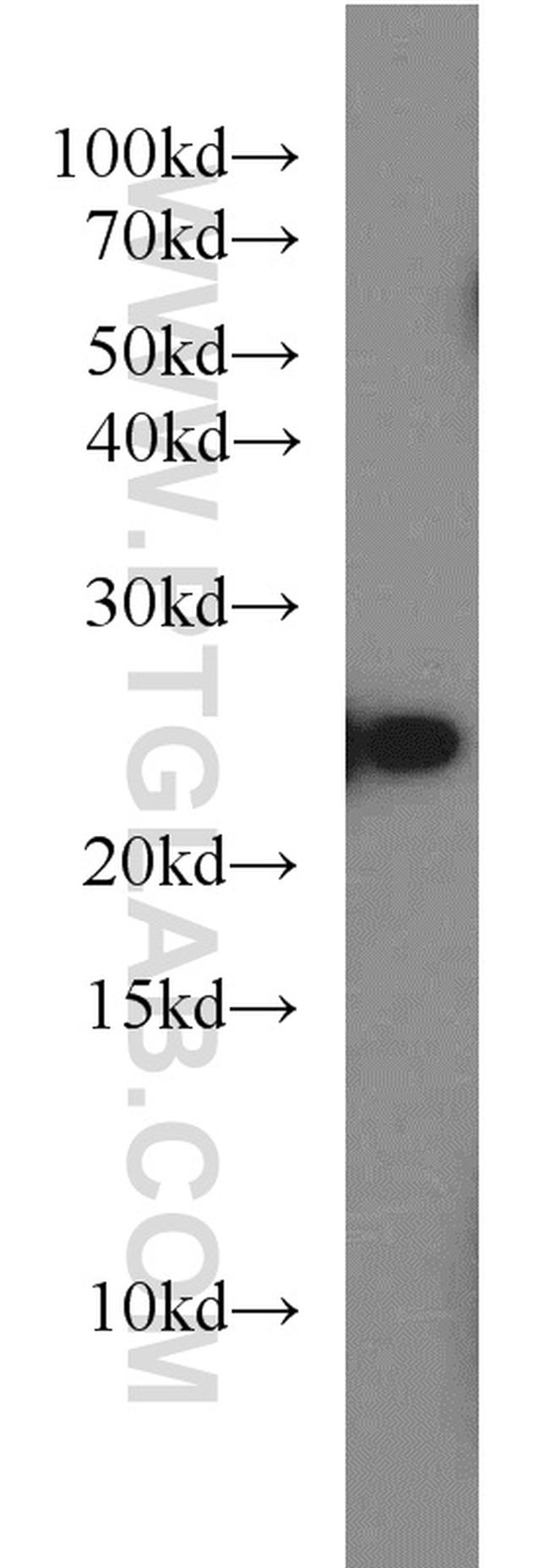 RAB8A Antibody in Western Blot (WB)