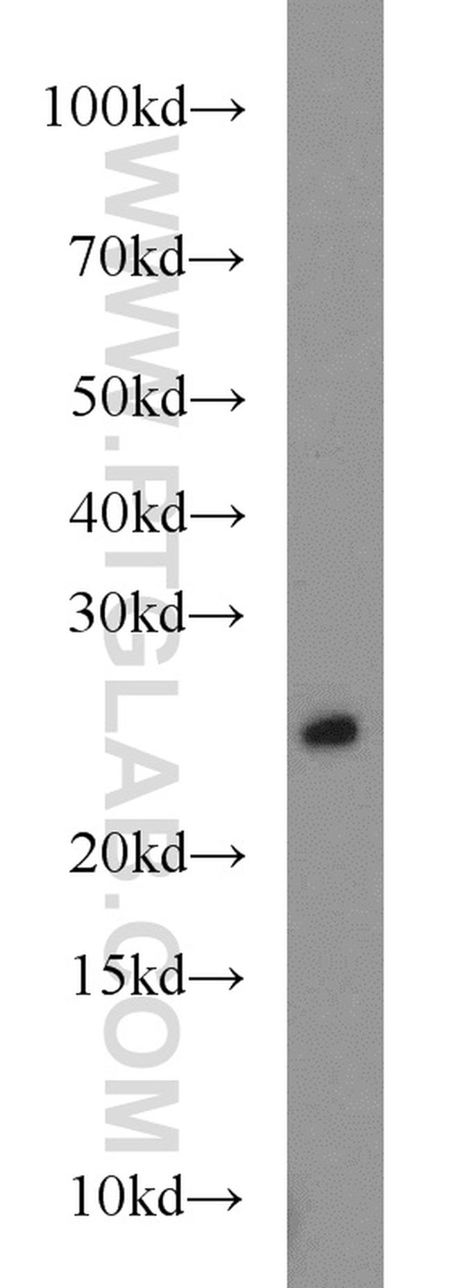 RAB8A Antibody in Western Blot (WB)