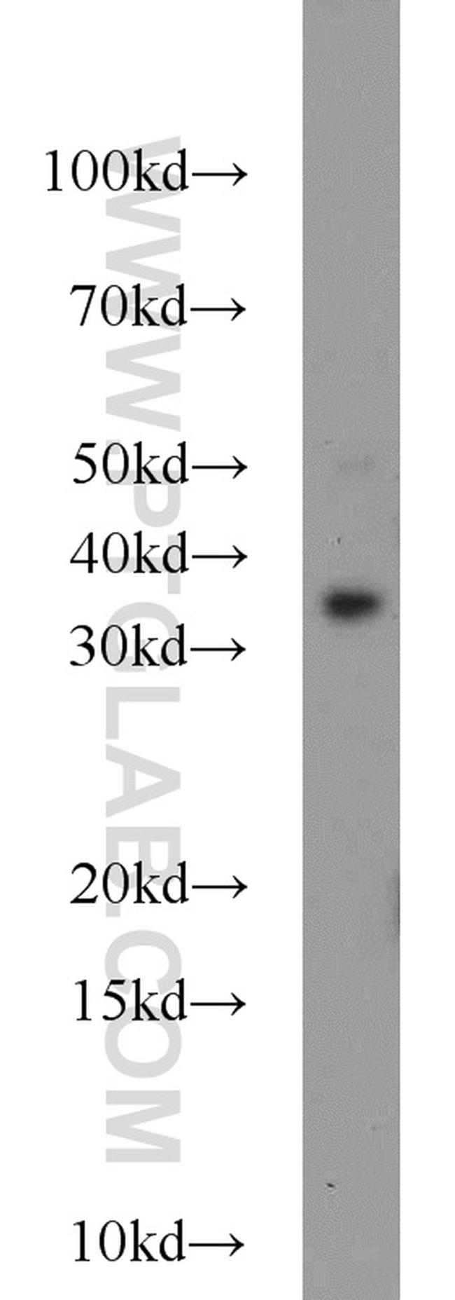 FOXE3 Antibody in Western Blot (WB)