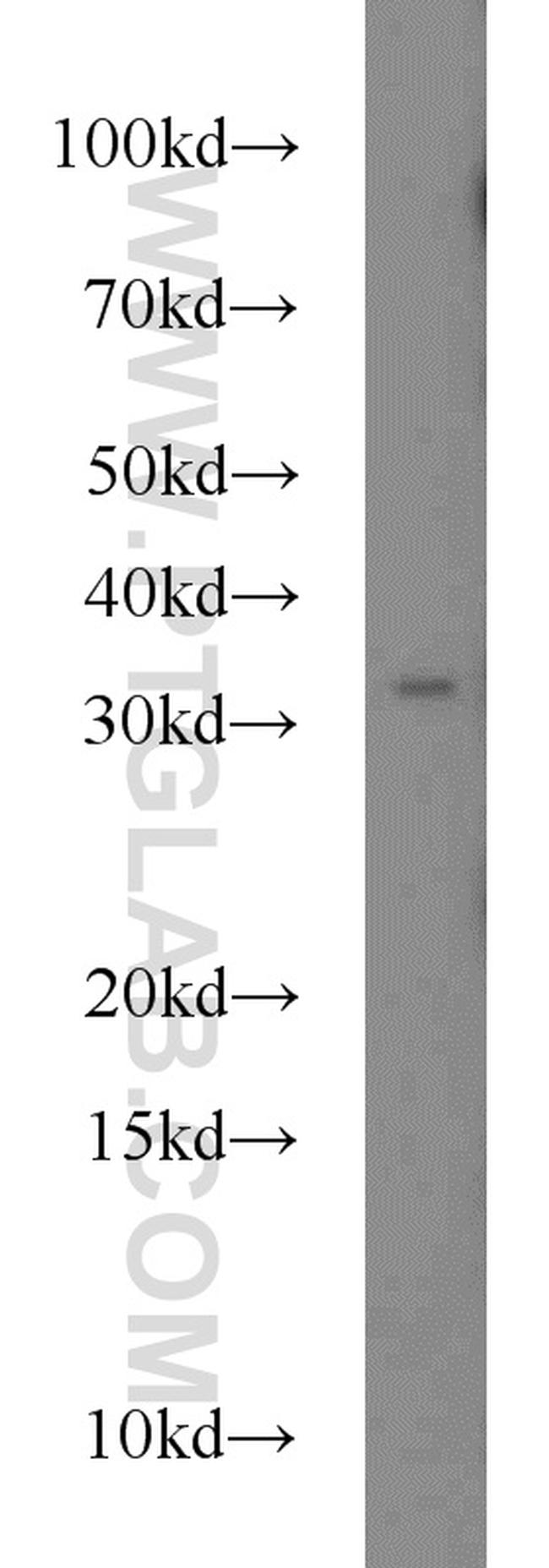 FOXE3 Antibody in Western Blot (WB)