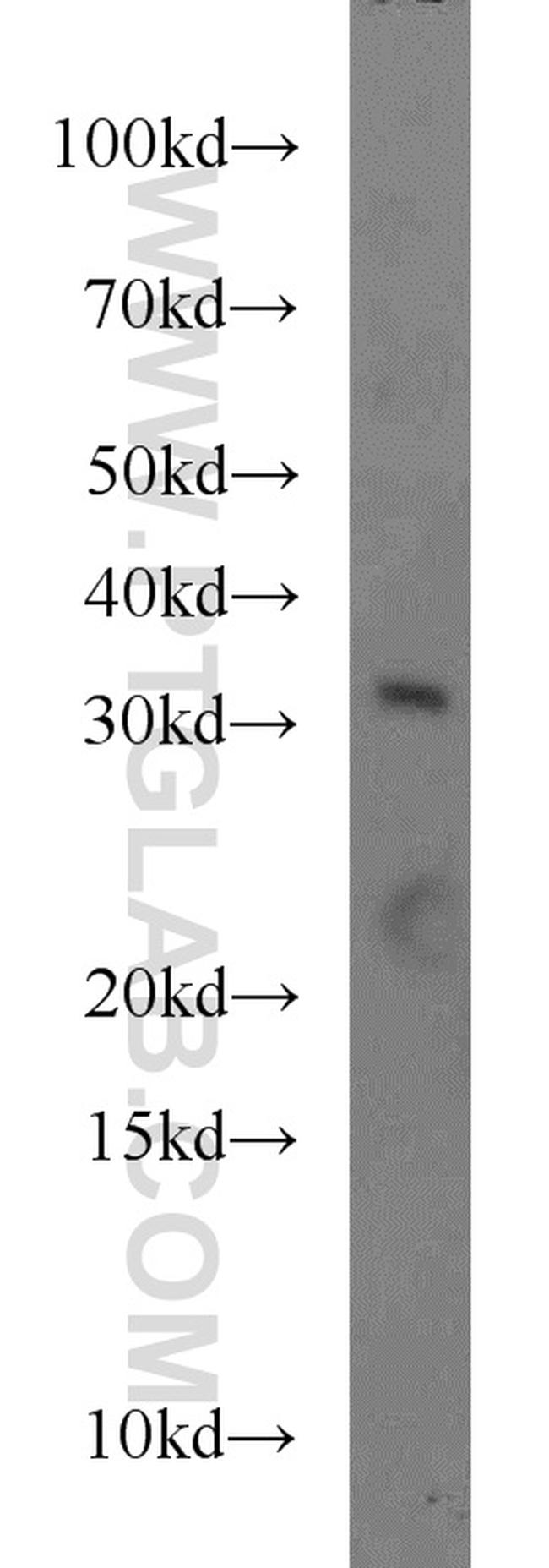 FOXE3 Antibody in Western Blot (WB)