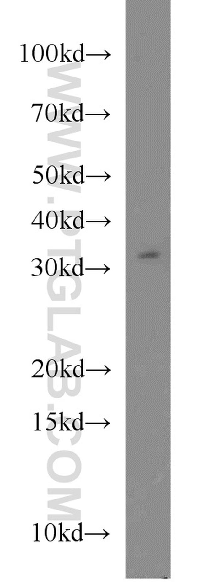 FOXE3 Antibody in Western Blot (WB)