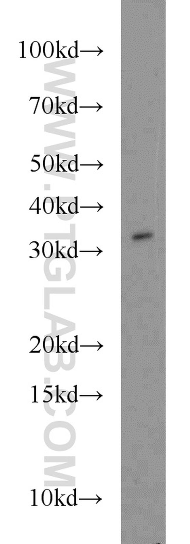 FOXE3 Antibody in Western Blot (WB)