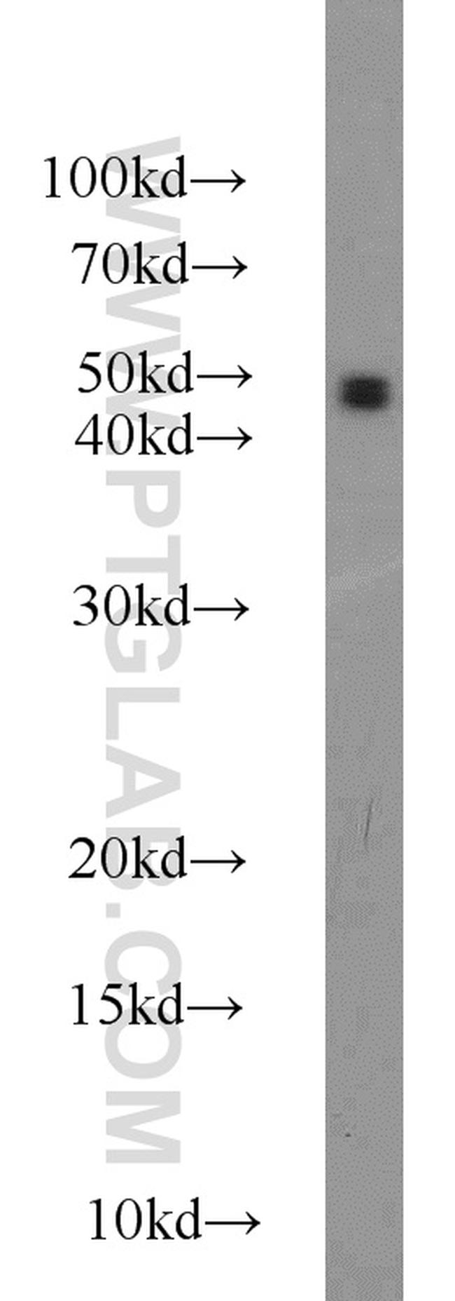 MAT2A Antibody in Western Blot (WB)