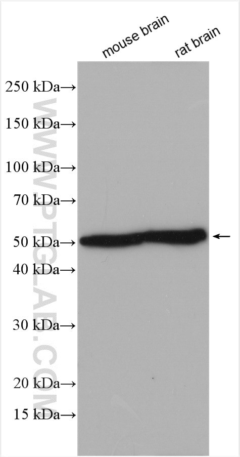 TBL1XR1 Antibody in Western Blot (WB)