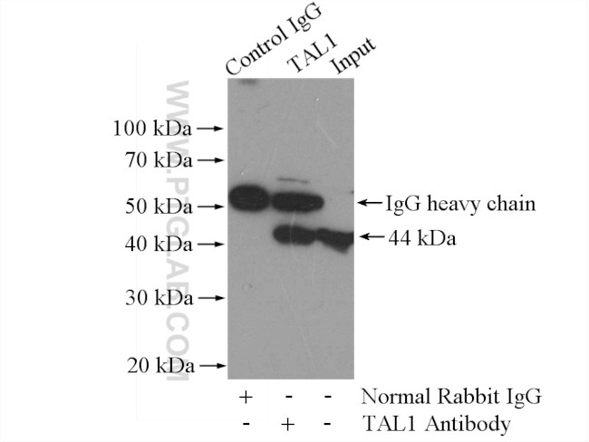 TAL1 Antibody in Immunoprecipitation (IP)