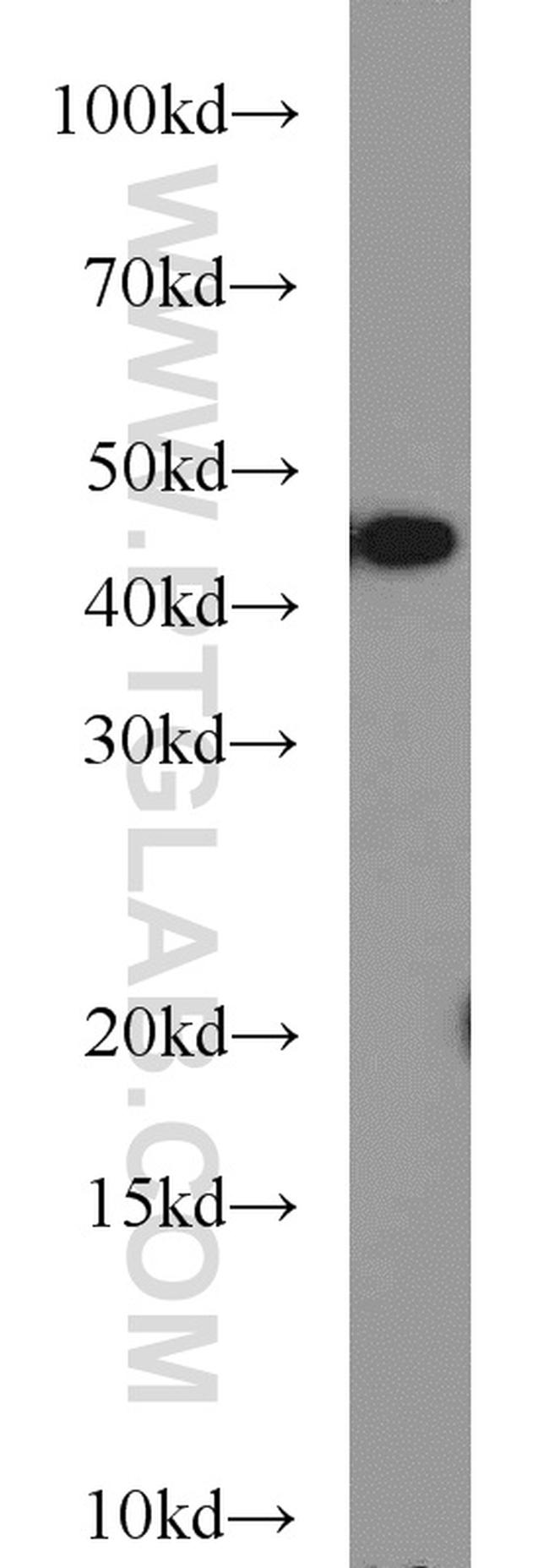 TAL1 Antibody in Western Blot (WB)