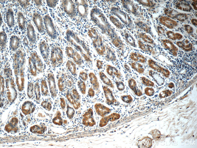 SEPN1 Antibody in Immunohistochemistry (Paraffin) (IHC (P))