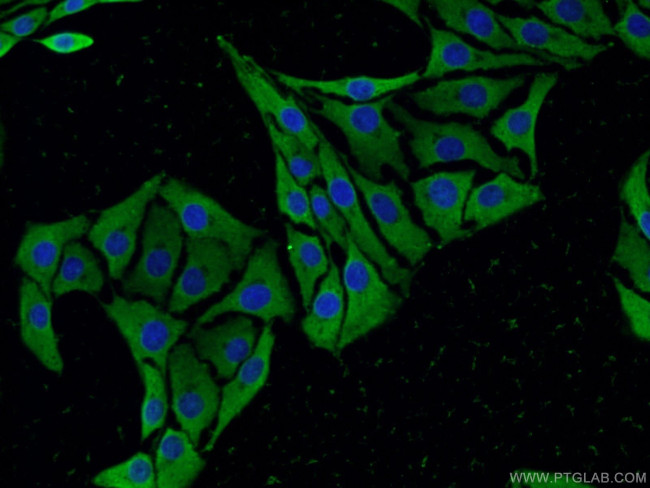 SCN10A Antibody in Immunocytochemistry (ICC/IF)