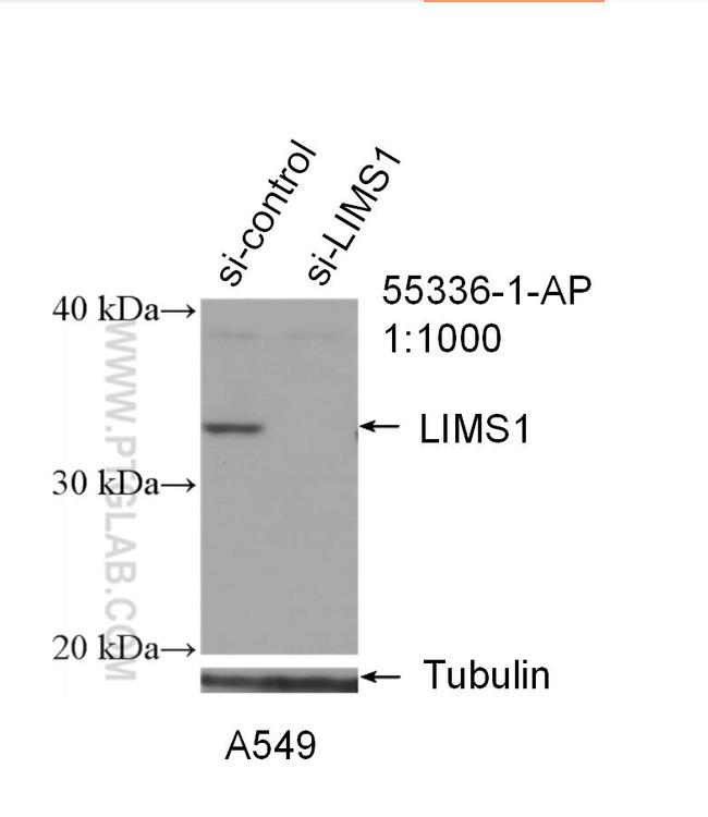 LIMS1 Antibody in Western Blot (WB)