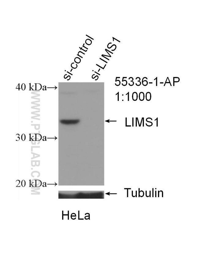 LIMS1 Antibody in Western Blot (WB)