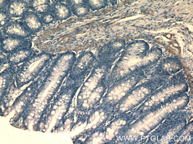 SIDT1 Antibody in Immunohistochemistry (Paraffin) (IHC (P))