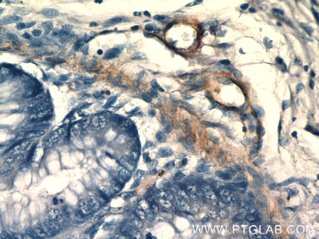 SIDT1 Antibody in Immunohistochemistry (Paraffin) (IHC (P))