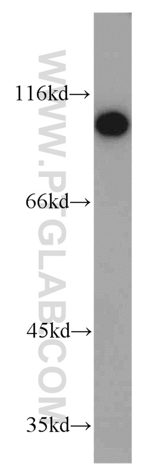 SIDT1 Antibody in Western Blot (WB)