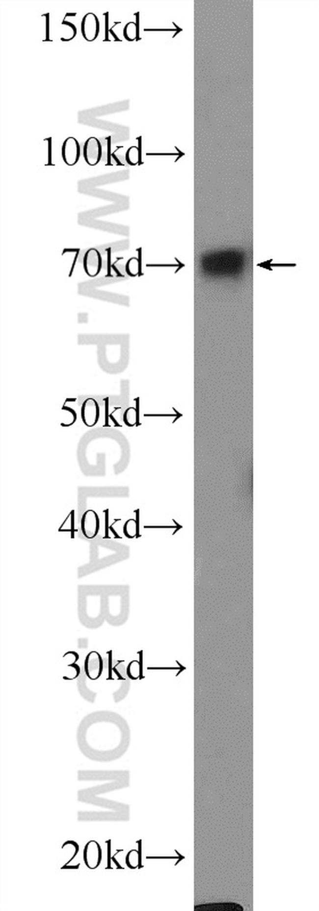 FOXC1 Antibody in Western Blot (WB)