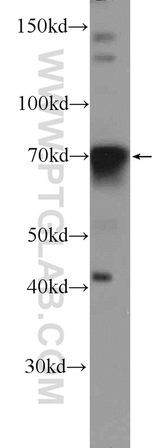 FOXC1 Antibody in Western Blot (WB)