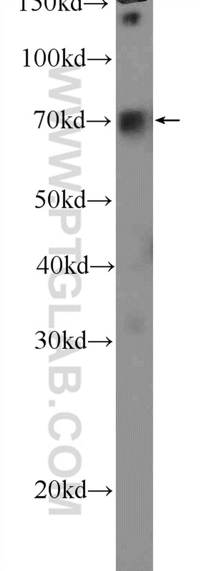 FOXC1 Antibody in Western Blot (WB)