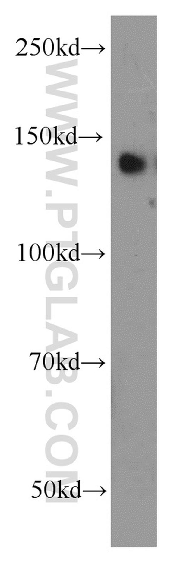 TRIM33 Antibody in Western Blot (WB)