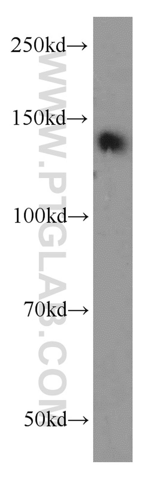 TRIM33 Antibody in Western Blot (WB)