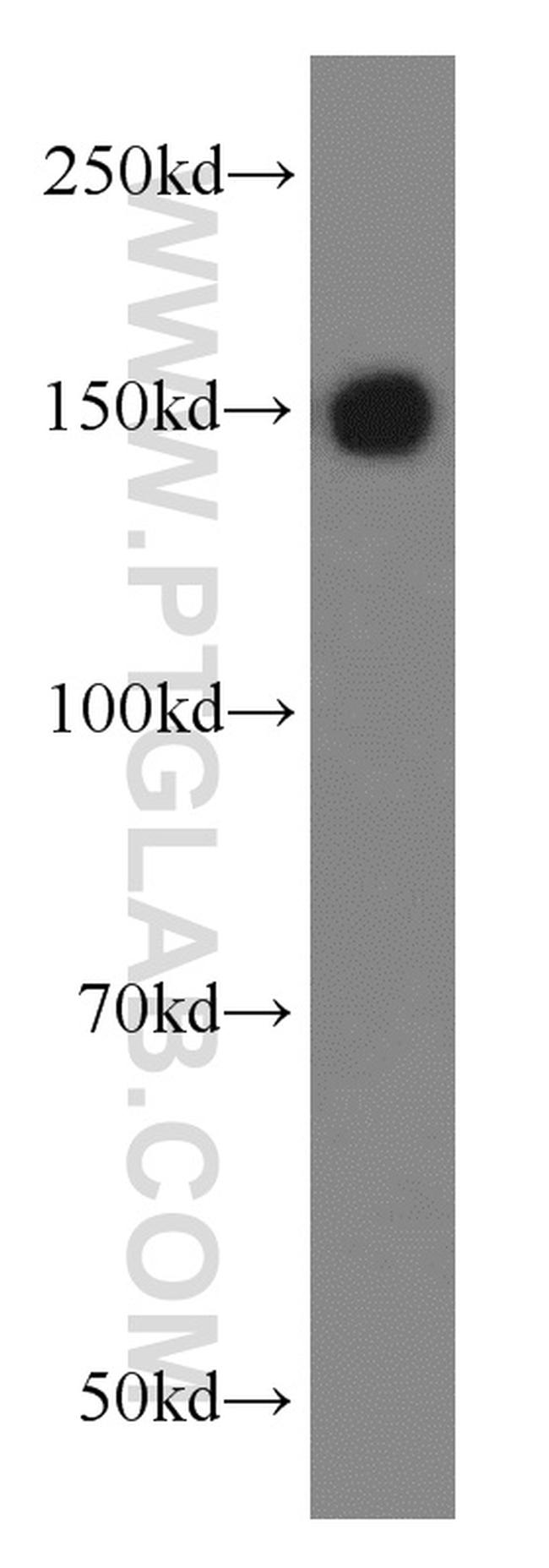 TRIM33 Antibody in Western Blot (WB)