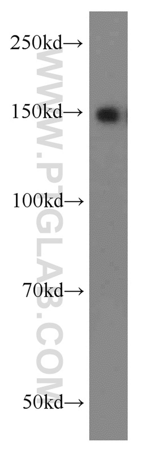 TRIM33 Antibody in Western Blot (WB)