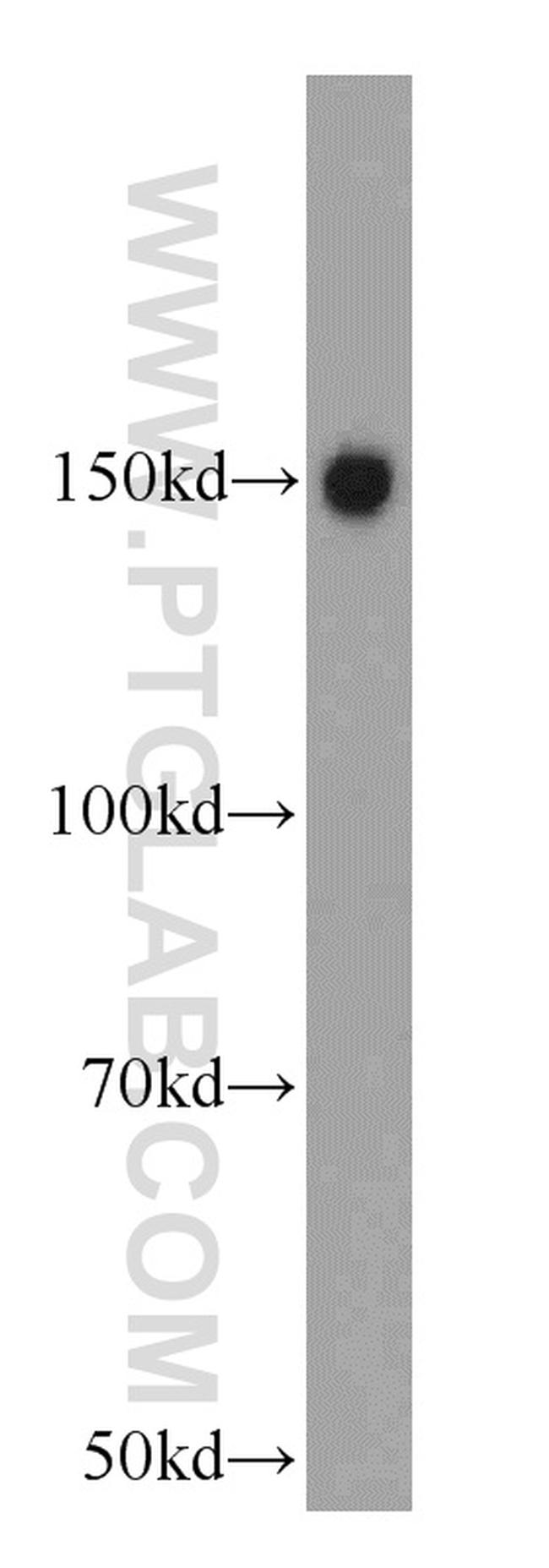 TRIM33 Antibody in Western Blot (WB)