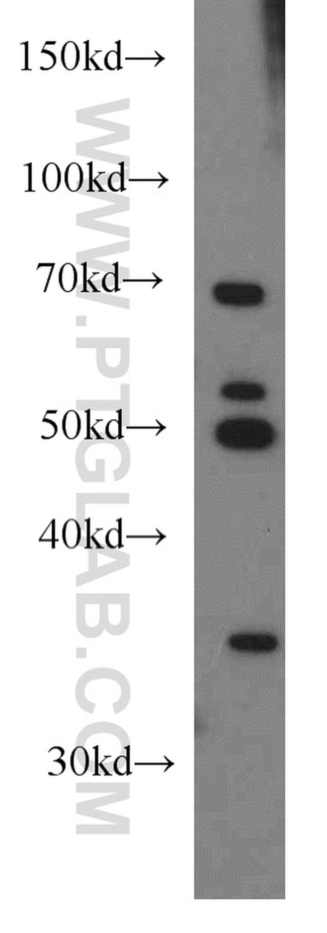 HLA-F Antibody in Western Blot (WB)