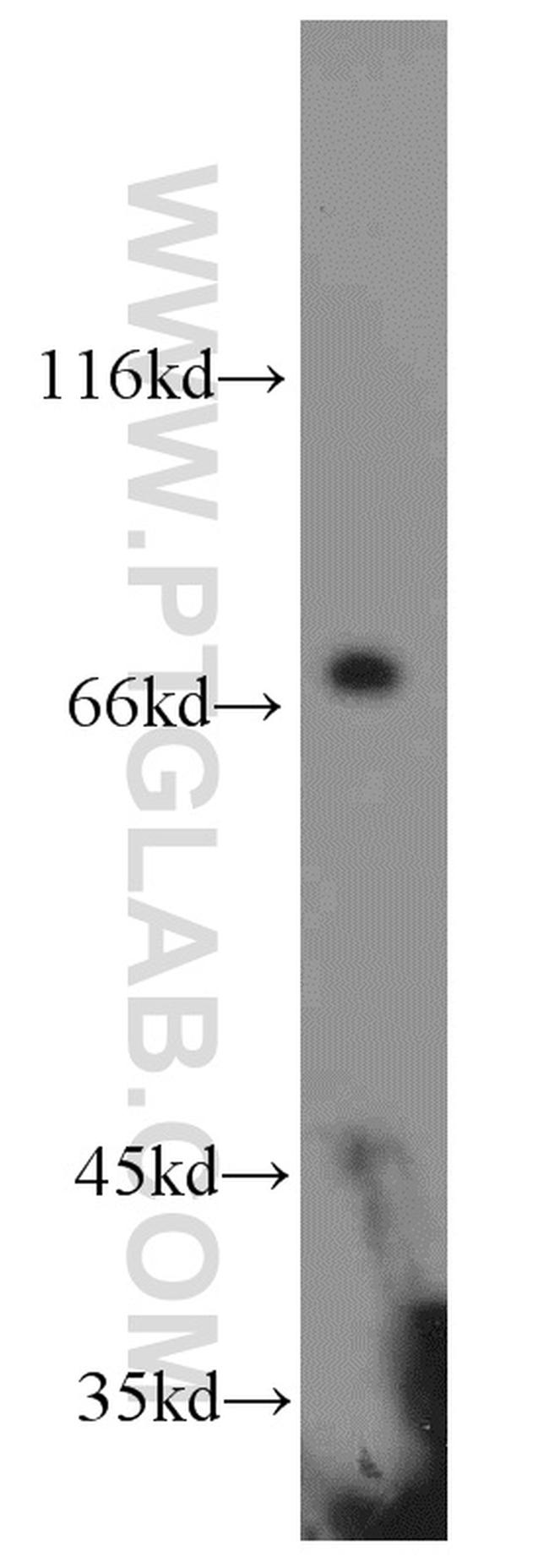 HLA-F Antibody in Western Blot (WB)