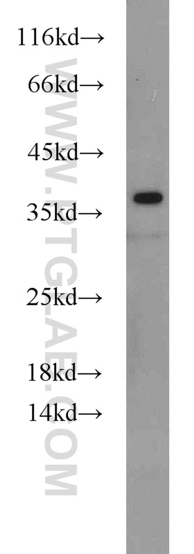 HLA-F Antibody in Western Blot (WB)