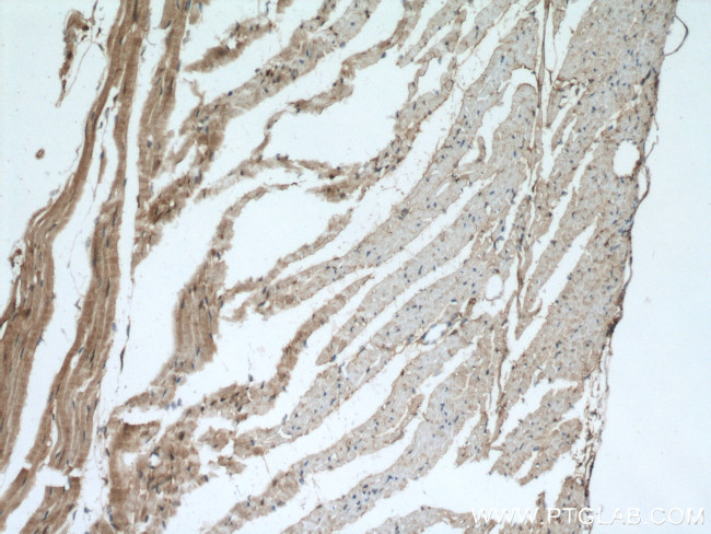 PYGB Antibody in Immunohistochemistry (Paraffin) (IHC (P))