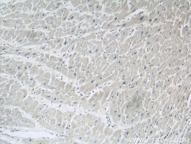 PYGB Antibody in Immunohistochemistry (Paraffin) (IHC (P))