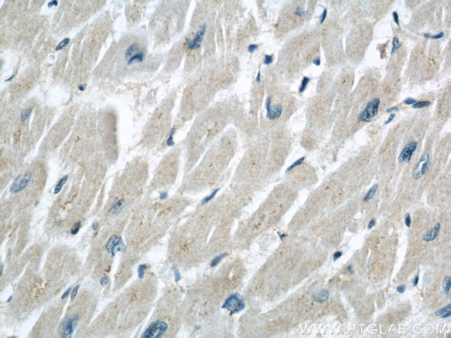 PYGB Antibody in Immunohistochemistry (Paraffin) (IHC (P))