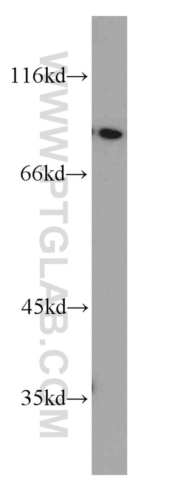 PYGB Antibody in Western Blot (WB)