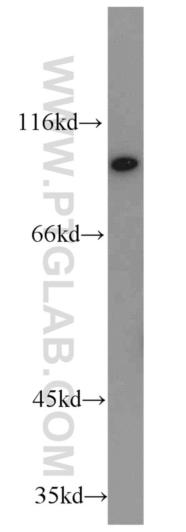 PYGB Antibody in Western Blot (WB)