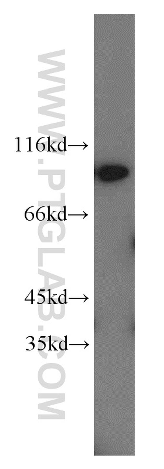 PYGB Antibody in Western Blot (WB)