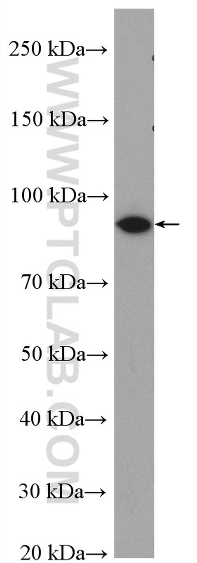 PYGB Antibody in Western Blot (WB)