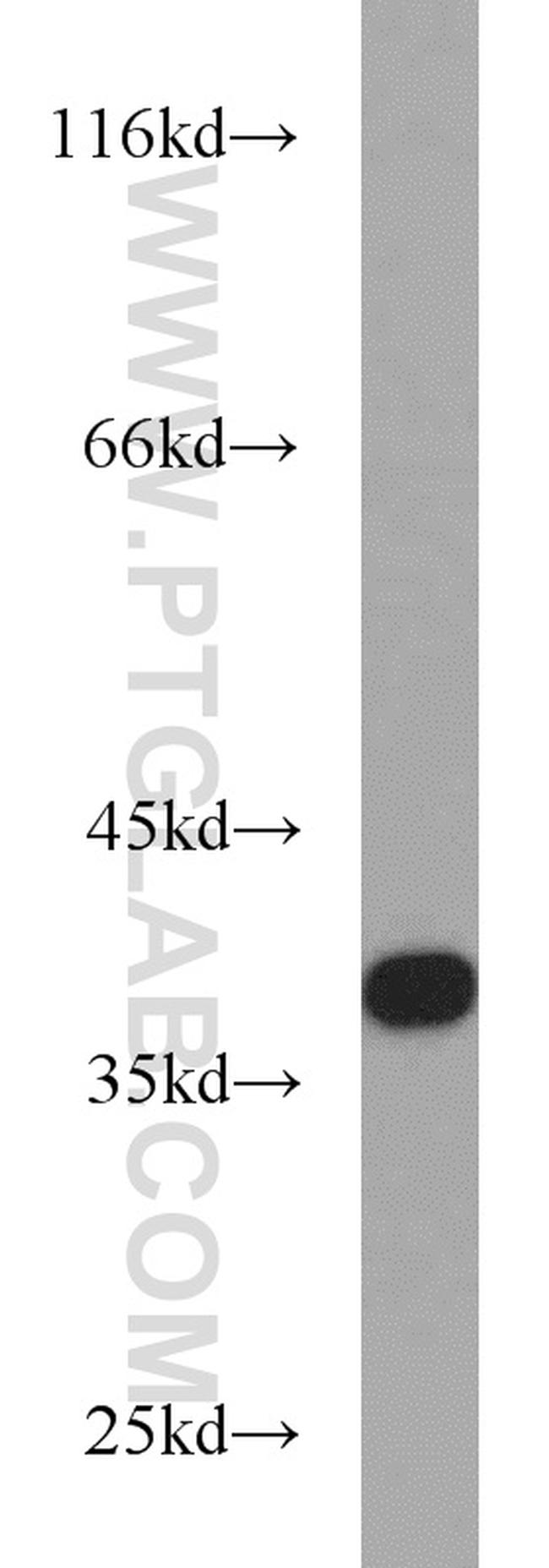 PKA C-beta Antibody in Western Blot (WB)