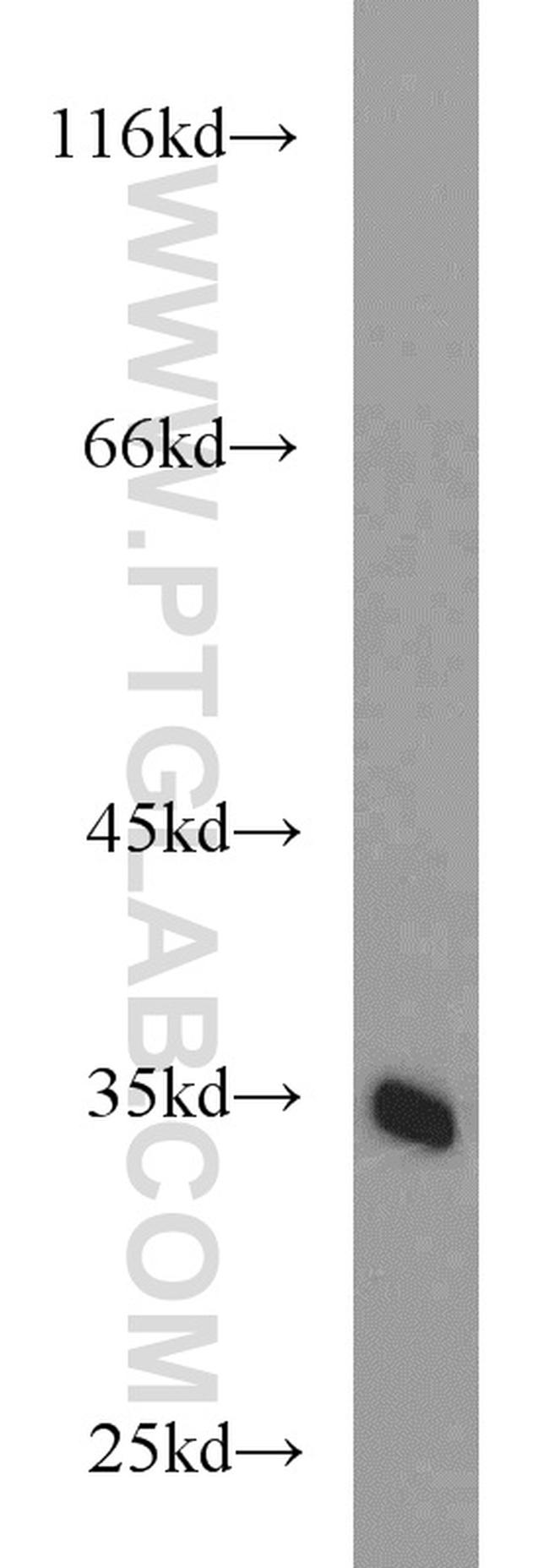 PKA C-beta Antibody in Western Blot (WB)