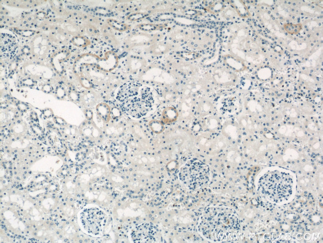 PKA C-beta Antibody in Immunohistochemistry (Paraffin) (IHC (P))